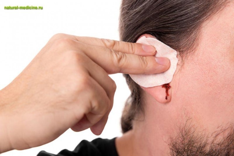 4 домашних средства от боли в ушах