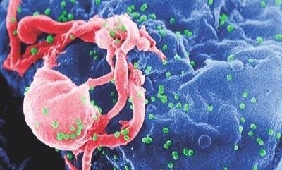 Где прячется ВИЧ или Почему невозможно вылечить СПИД?