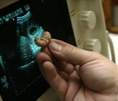 Как аборт влияет на последующую беременность