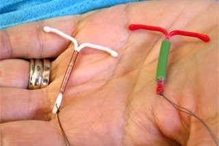 Внутриматочная контрацепция: чем опасны спирали