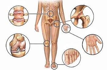 Заболевания суставов: причины и лечение