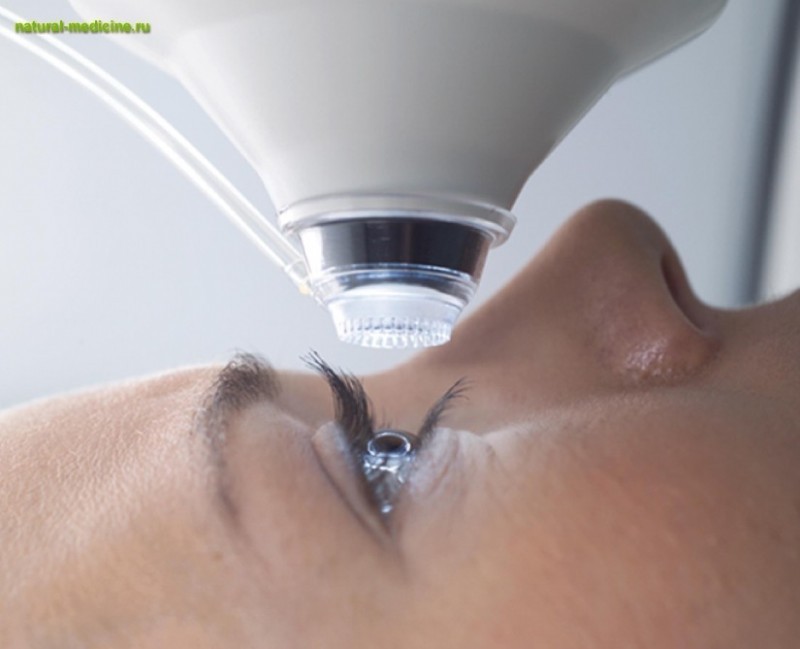 Фемтосекундный лазер для восстановления зрения – точный, быстрый, эффективный
