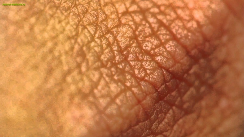 Виды кожных заболеваний