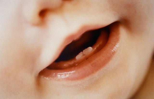 Как помочь малышу, у которого режутся зубки?
