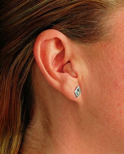 Современные слуховые аппараты: функциональные и малозаметные