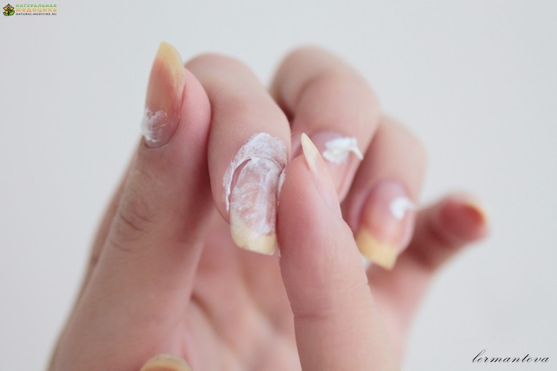 6 способов восстановить поврежденные ногти