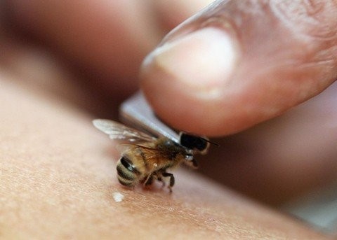 Апитерапия или лечение пчелиным ядом