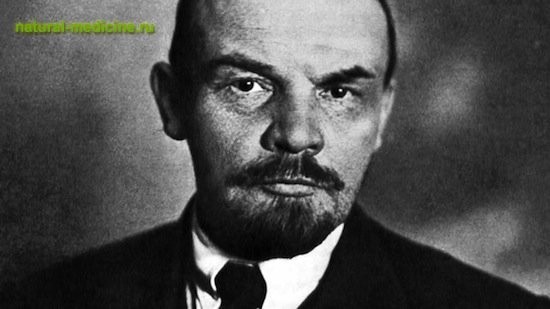 Мозг вождя: о болезни и инсульте Ленина
