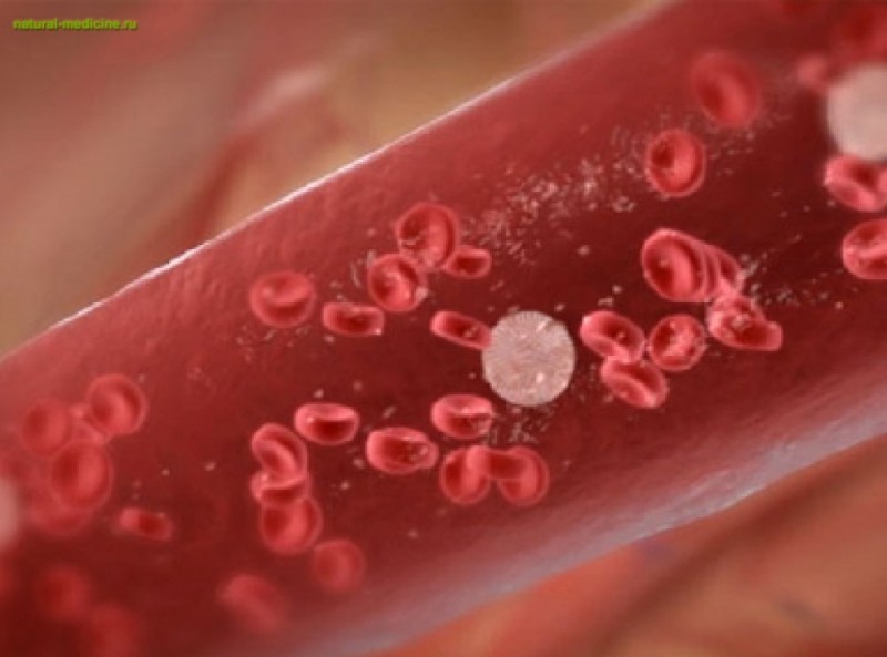 Многие виды рака крови поддаются лечению