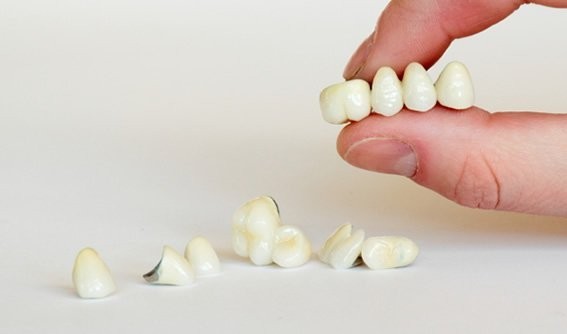 Протезирование зубов: виды протезов и технологии