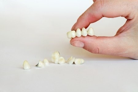 6 рекомендаций, если сломался зубной протез и 4 основных причины