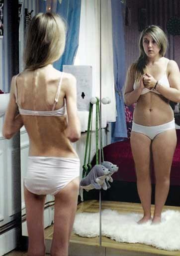 Две трети худеющих женщин не имеют лишнего веса