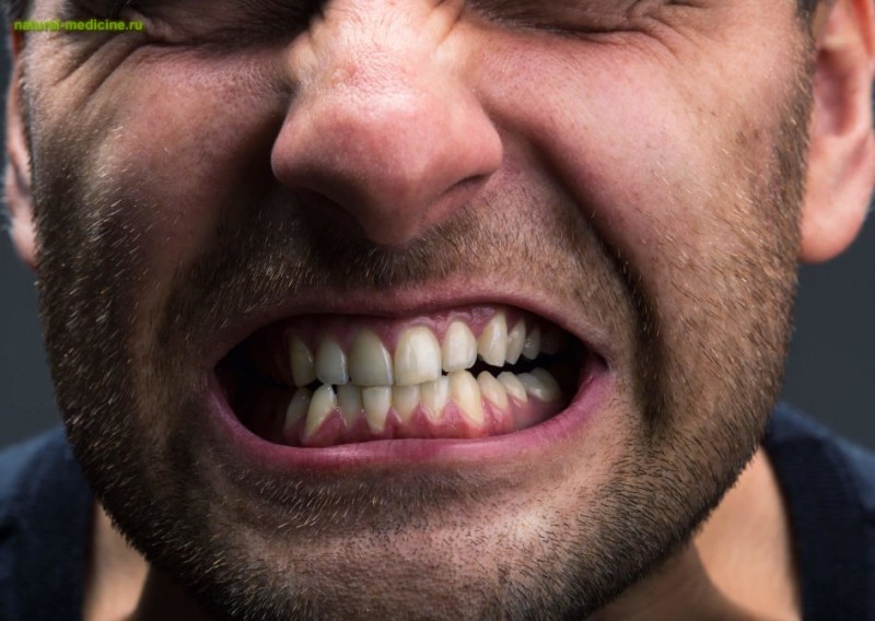 Опасный недуг – бруксизм. Отчего возникает скрип зубами во сне?