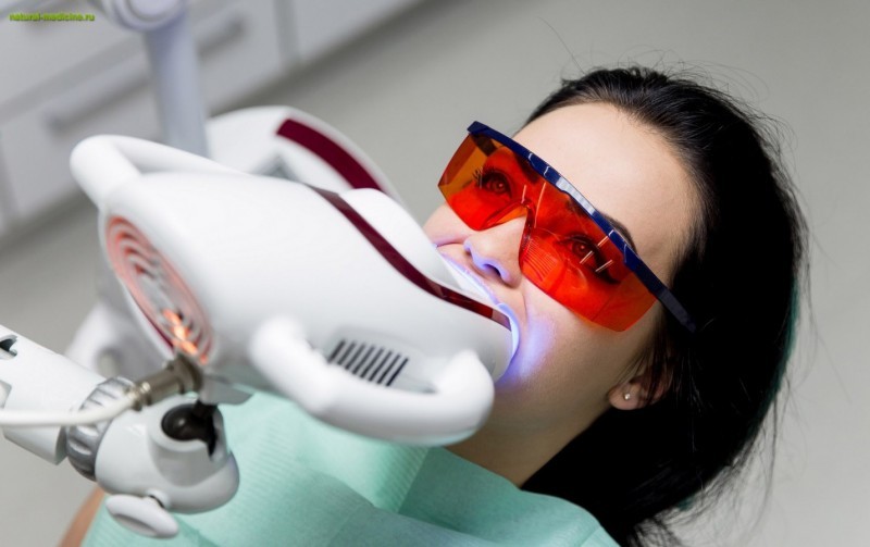 Отбеливание зубов: история и 6 современных клинических методов
