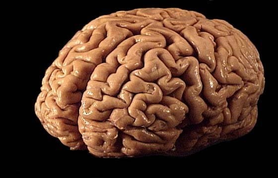 Признаки проблем с мозгом