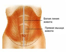 Лечение предбрюшинной липомы (грыжи)