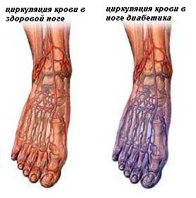 циркуляция крови в ногах