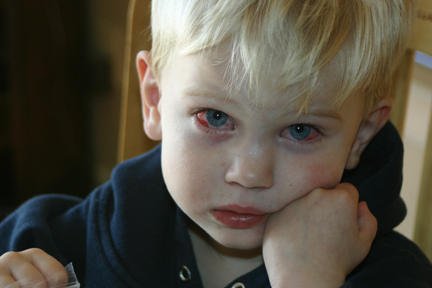 Нарушения зрения у детей до 3 лет: 5 признаков