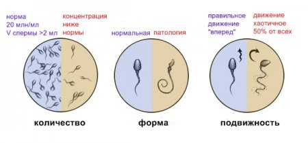 Качество сперматозоидов