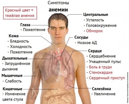 Симптомы анемии (перевод Терентьев Владимир - https://vk.com/massman)