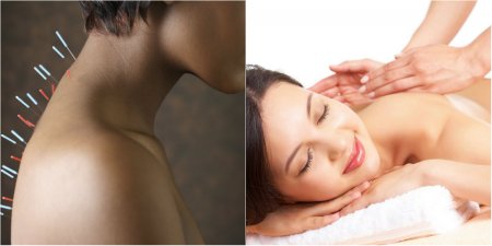 Иглоукалывание и массаж